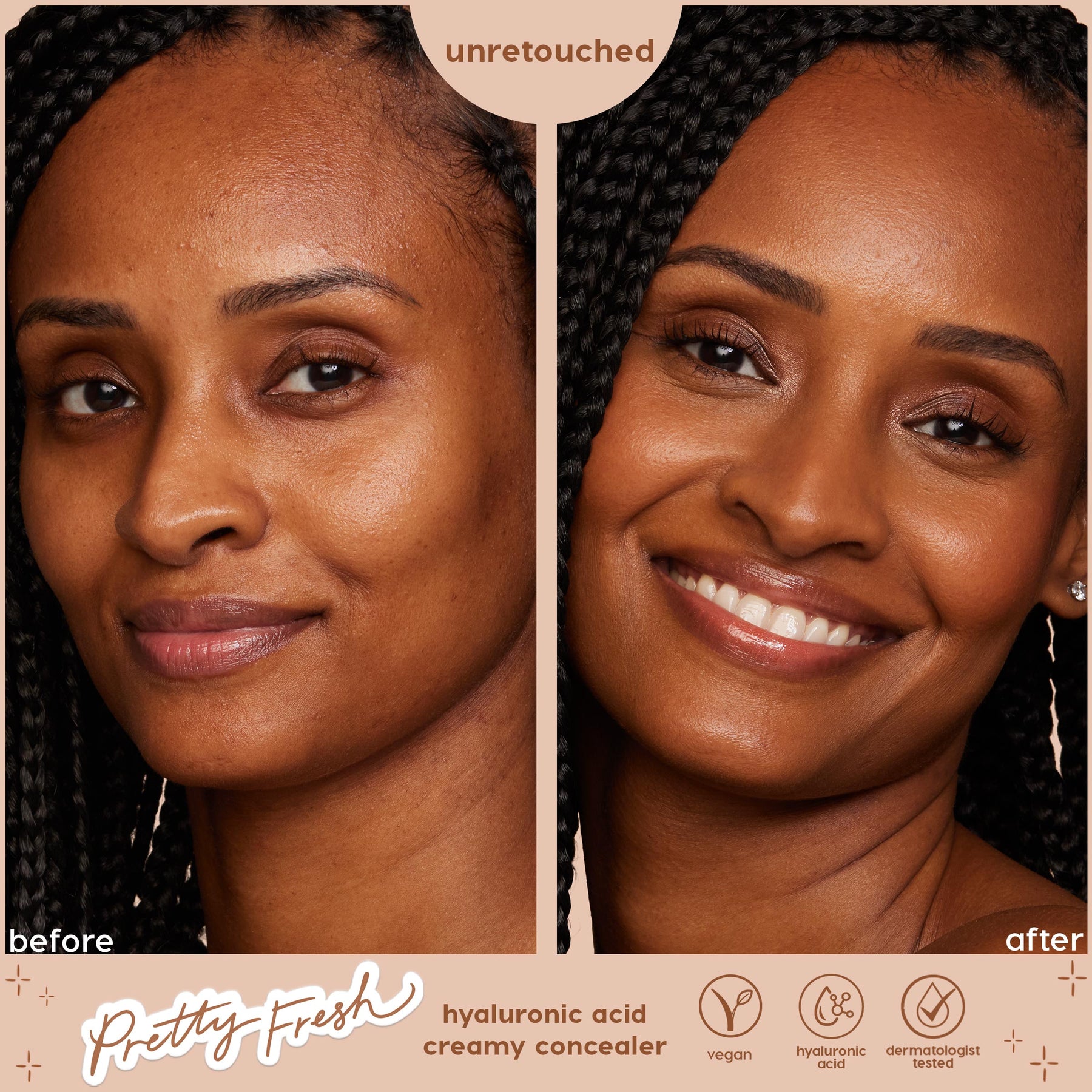 Dark 170 N - Buildable Limited Complexion Kit
